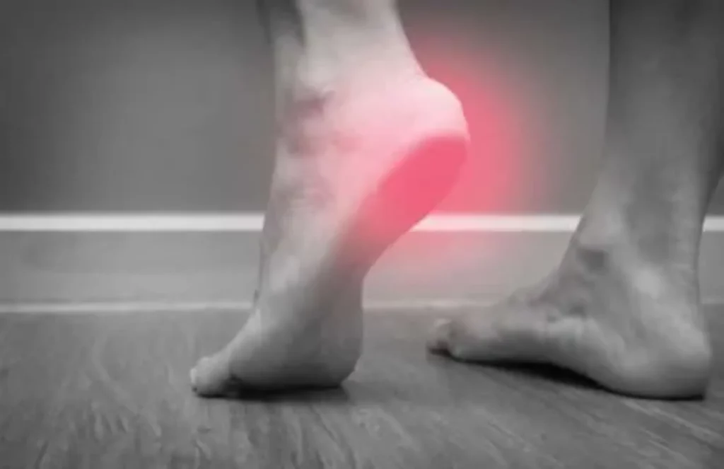 heel pain treatment 500x324 1